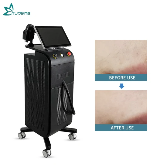 Bester Preis 755/808/1064 Diodenlaser-Haarentfernungsgerät